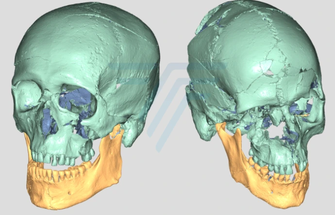 Comparaison 3D de variantes d'une pièce industrielle